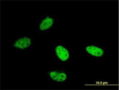 Immunocytochemistry/ Immunofluorescence: LSD1 Antibody (2E7) [H00023028-M04]