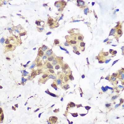 Immunohistochemistry-Paraffin: LSD1 Antibody (7R10X6) [NBP3-16688]