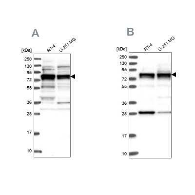 Western Blot: LSG1 Antibody [NBP2-32698]