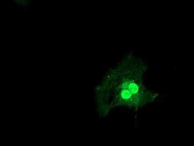 Immunocytochemistry/ Immunofluorescence: LSM1 Antibody (OTI5C6) [NBP2-00918]