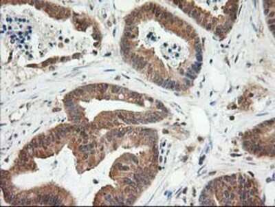 Immunohistochemistry-Paraffin: LSM1 Antibody (OTI5C6) [NBP2-00918]