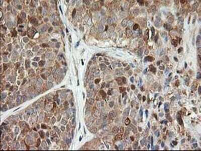 Immunohistochemistry: LSM1 Antibody (OTI5C6) - Azide and BSA Free [NBP2-72547]