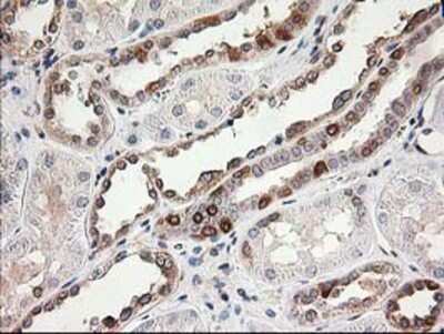 Immunohistochemistry: LSM1 Antibody (OTI5C6) - Azide and BSA Free [NBP2-72547]