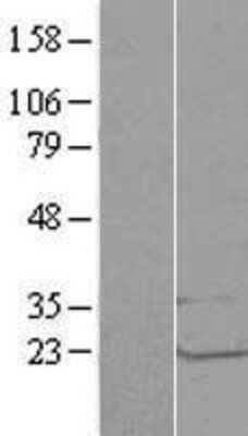 Western Blot: LSM1 Overexpression Lysate [NBL1-12720]