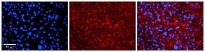Immunohistochemistry: LSM14A Antibody [NBP1-56784]