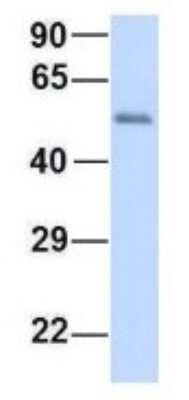 Western Blot: LSM14A Antibody [NBP1-56588]