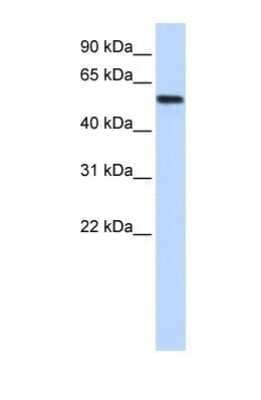 Western Blot: LSM14A Antibody [NBP1-56784]