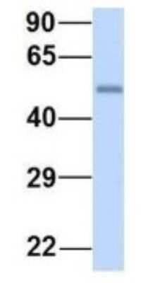 Western Blot: LSM14A Antibody [NBP1-56784]
