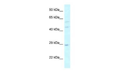 Western Blot: LSM14A Antibody [NBP1-56784]