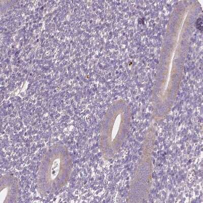 Immunohistochemistry-Paraffin: LSM14B Antibody [NBP2-56828]