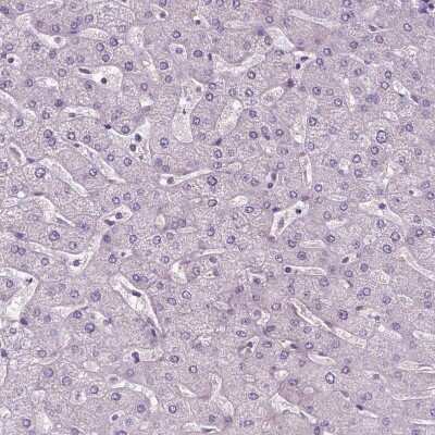 Immunohistochemistry-Paraffin: LSM14B Antibody [NBP2-56828]
