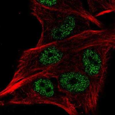 Immunocytochemistry/ Immunofluorescence: LSM2 Antibody [NBP2-38093]
