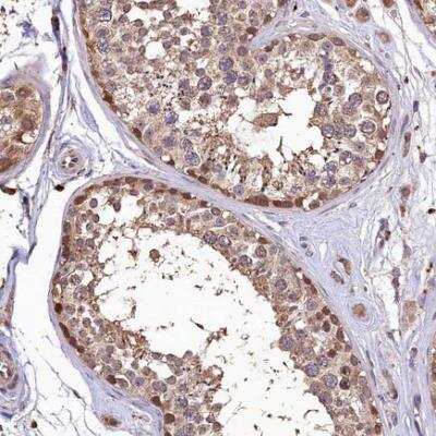 Immunohistochemistry-Paraffin: LSM4 Antibody [NBP1-86846]