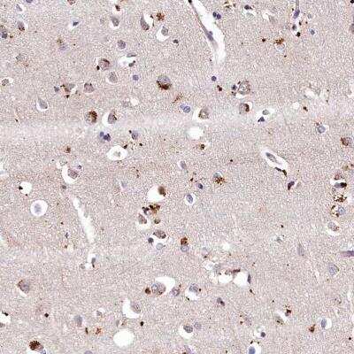 Immunohistochemistry-Paraffin: LSM4 Antibody [NBP1-86846]