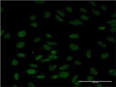 Immunocytochemistry/ Immunofluorescence: LSM6 Antibody (4B5-1B10) [H00011157-M01]