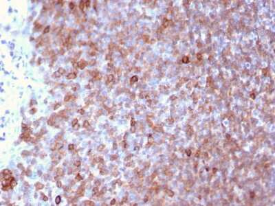 Immunohistochemistry-Paraffin: LSP1 Antibody (LSP1/3025) [NBP2-79725]