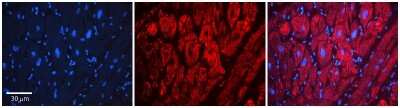 Immunohistochemistry: LSS Antibody [NBP1-53166]