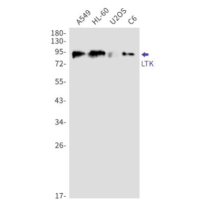 Western Blot: LTK Antibody (S02-8A4) [NBP3-19886]