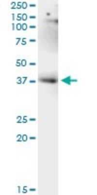 Immunoprecipitation: LUC7L Antibody (2D10) [H00055692-M05]