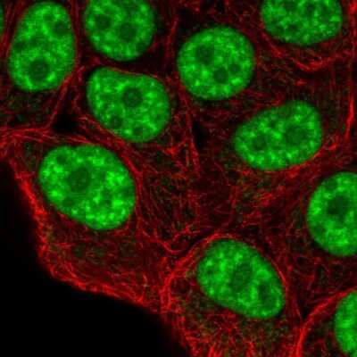 Immunocytochemistry/ Immunofluorescence: LUC7L Antibody [NBP2-56401]