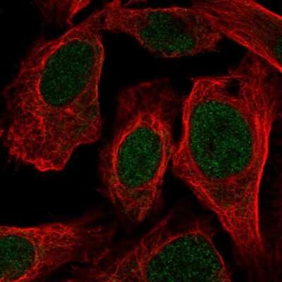 Immunocytochemistry/ Immunofluorescence: LUC7L Antibody [NBP2-58207]