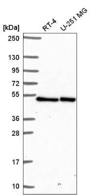 Western Blot: LUC7L Antibody [NBP2-56401]