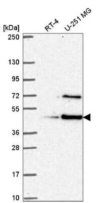 Western Blot: LUC7L Antibody [NBP2-58207]