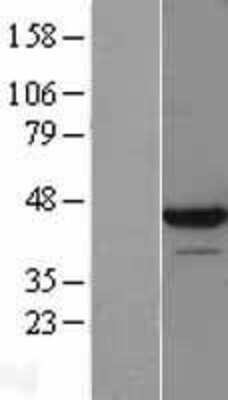 Western Blot: LUC7L Overexpression Lysate [NBL1-12743]