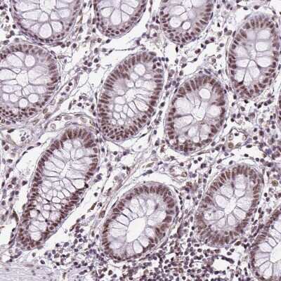 Immunohistochemistry-Paraffin: LUC7L2 Antibody [NBP2-33621]