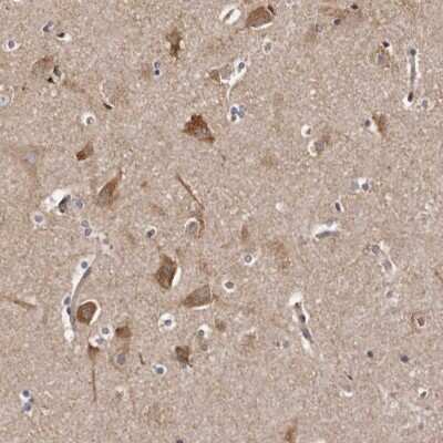 Immunohistochemistry-Paraffin: LUZP1 Antibody [NBP1-81282]