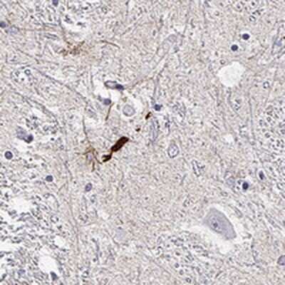 Immunohistochemistry-Paraffin: LUZP2 Antibody [NBP2-14564]