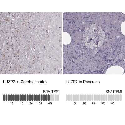 Immunohistochemistry-Paraffin: LUZP2 Antibody [NBP2-14564]
