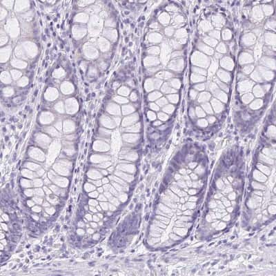 Immunohistochemistry-Paraffin: LUZP4 Antibody [NBP1-94093]
