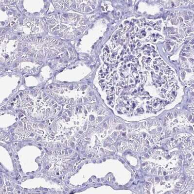 Immunohistochemistry-Paraffin: LUZP4 Antibody [NBP2-33634]