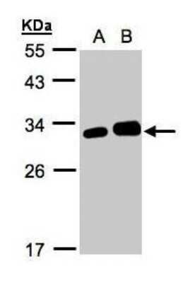 Western Blot: Latexin Antibody [NBP1-32525]