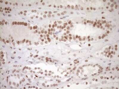 Immunohistochemistry: LXR alpha/NR1H3 Antibody (OTI1A5) [NBP2-46220]