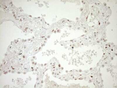 Immunohistochemistry: LXR alpha/NR1H3 Antibody (OTI1A5) [NBP2-46220]