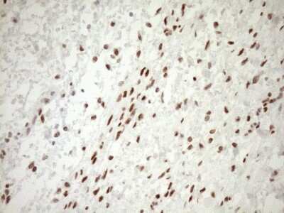 Immunohistochemistry: LXR alpha/NR1H3 Antibody (OTI1A5) [NBP2-46220]
