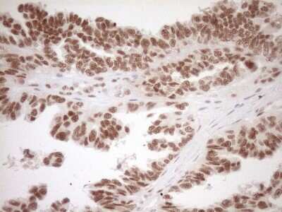 Immunohistochemistry: LXR alpha/NR1H3 Antibody (OTI1A5) [NBP2-46220]