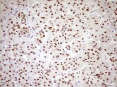 Immunohistochemistry: LXR alpha/NR1H3 Antibody (OTI1A5) [NBP2-46220]