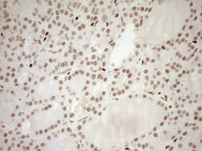 Immunohistochemistry: LXR alpha/NR1H3 Antibody (OTI1A5) [NBP2-46220]