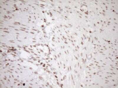 Immunohistochemistry: LXR alpha/NR1H3 Antibody (OTI1A5) [NBP2-46220]