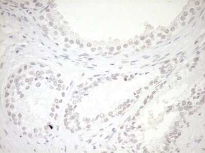 Immunohistochemistry: LXR alpha/NR1H3 Antibody (OTI1A5) [NBP2-46220]