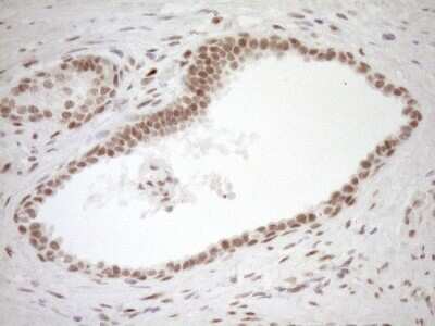 Immunohistochemistry: LXR alpha/NR1H3 Antibody (OTI1A5) [NBP2-46220]