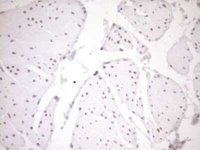 Immunohistochemistry: LXR alpha/NR1H3 Antibody (OTI1A5) [NBP2-46220]