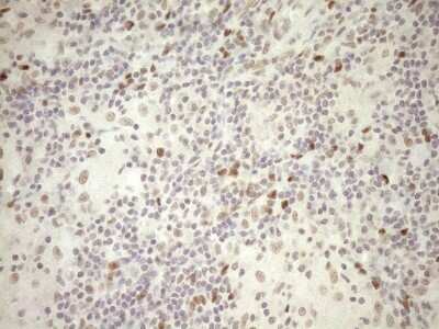 Immunohistochemistry: LXR alpha/NR1H3 Antibody (OTI1A5) [NBP2-46220]