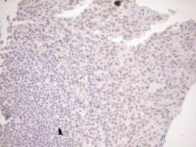 Immunohistochemistry: LXR alpha/NR1H3 Antibody (OTI1A5) [NBP2-46220]