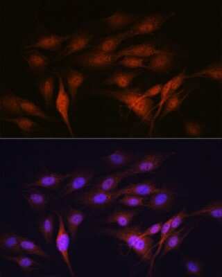 Immunocytochemistry/ Immunofluorescence: LXR alpha/NR1H3 Antibody (7Z4H10) [NBP3-16304]