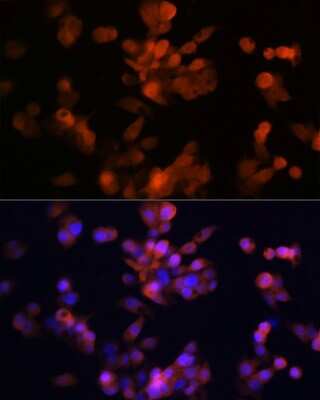 Immunocytochemistry/ Immunofluorescence: LXR alpha/NR1H3 Antibody (7Z4H10) [NBP3-16304]