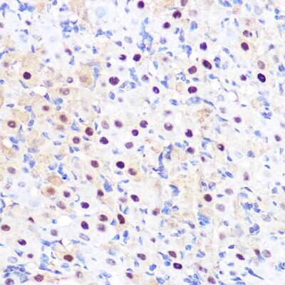 Immunohistochemistry-Paraffin: LXR alpha/NR1H3 Antibody (7Z4H10) [NBP3-16304]